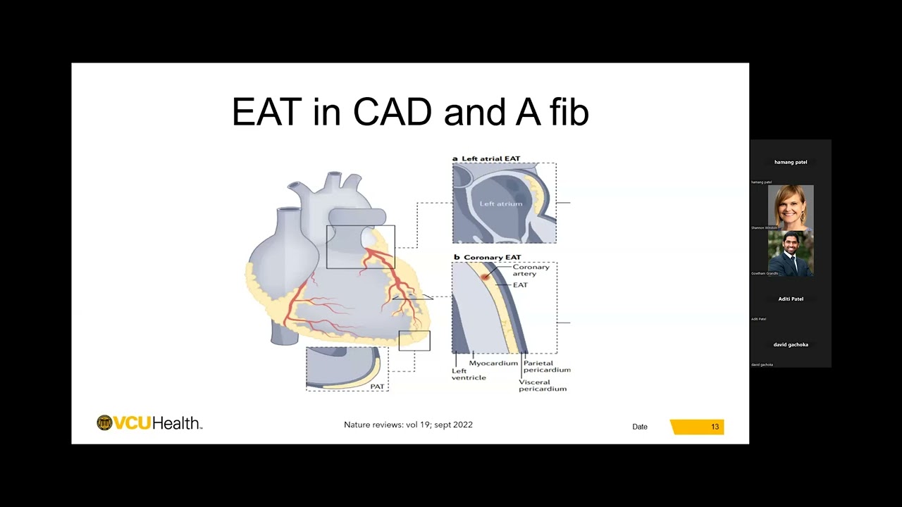 Pauley Heart Center Cardiology Grand Rounds - May 30, 2024