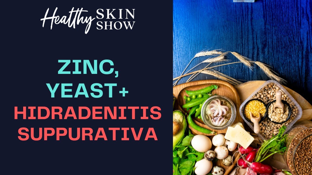 How Yeast + Zinc Can Play A Role In HIDRADENITIS SUPPURATIVA | Steve Daveluy, MD