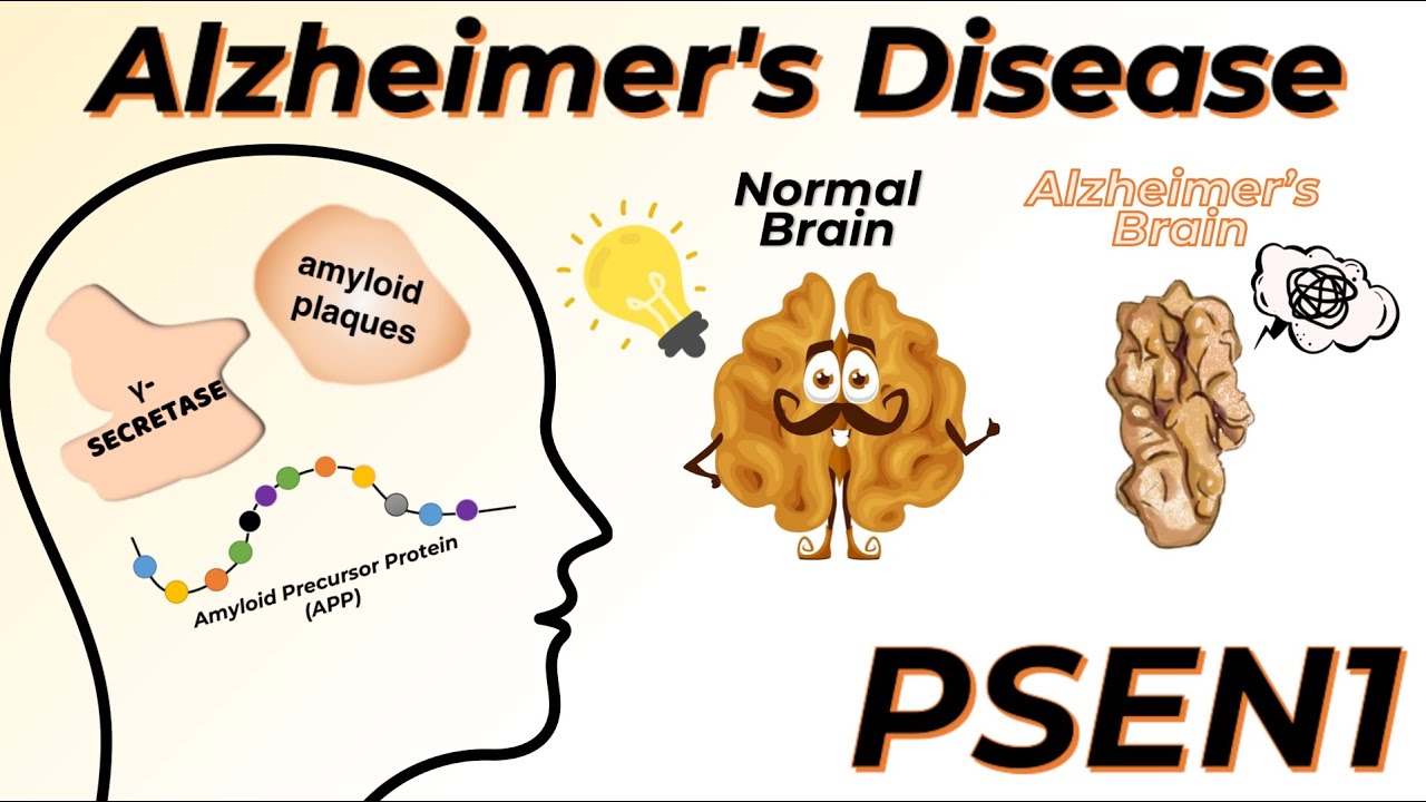 The real story behind Alzheimer&rsquo;s Disease and PSEN1