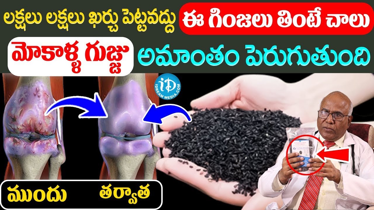 Dr CL Venkat Rao - మోకాళ్ళ నొప్పి పోయి లేచి పరుగెడుతారు | Knee Pain Relief | iD Health Care