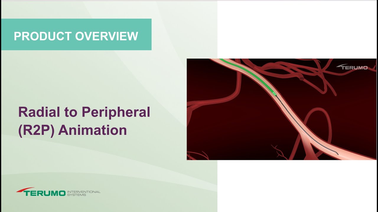 Radial to Peripheral (R2P) Animation | Terumo Interventional Systems