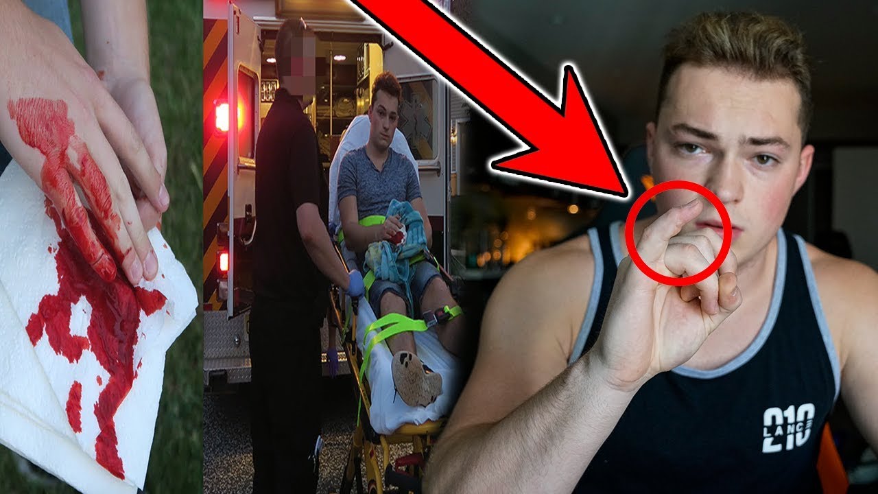 My Fruit Ninja Finger ONE YEAR LATER.. (Emotional)