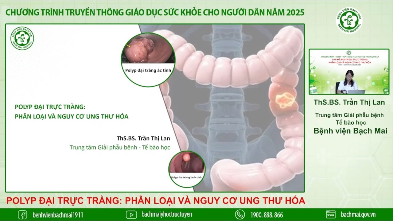 23. Polyp đại trực tràng: phân loại và nguy cơ ung thư hóa