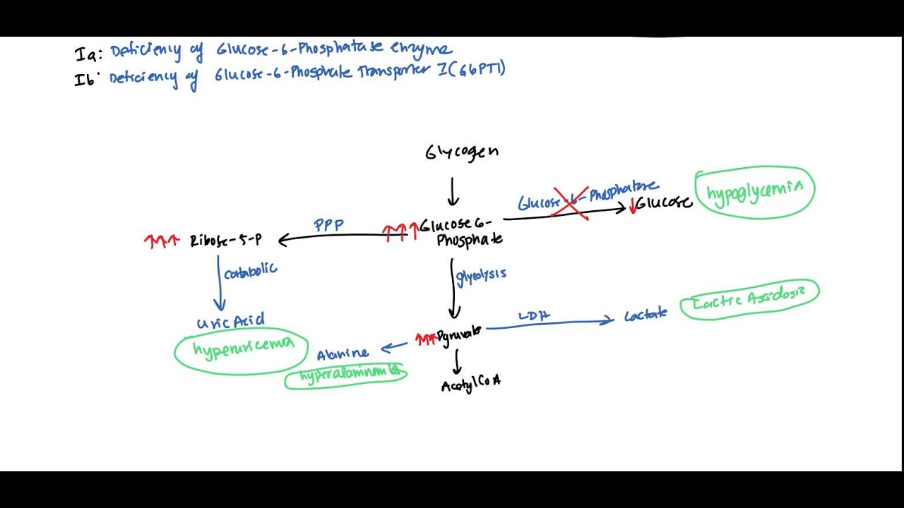 Von Gierke (Glycogen Storage Disease 1) for USMLE