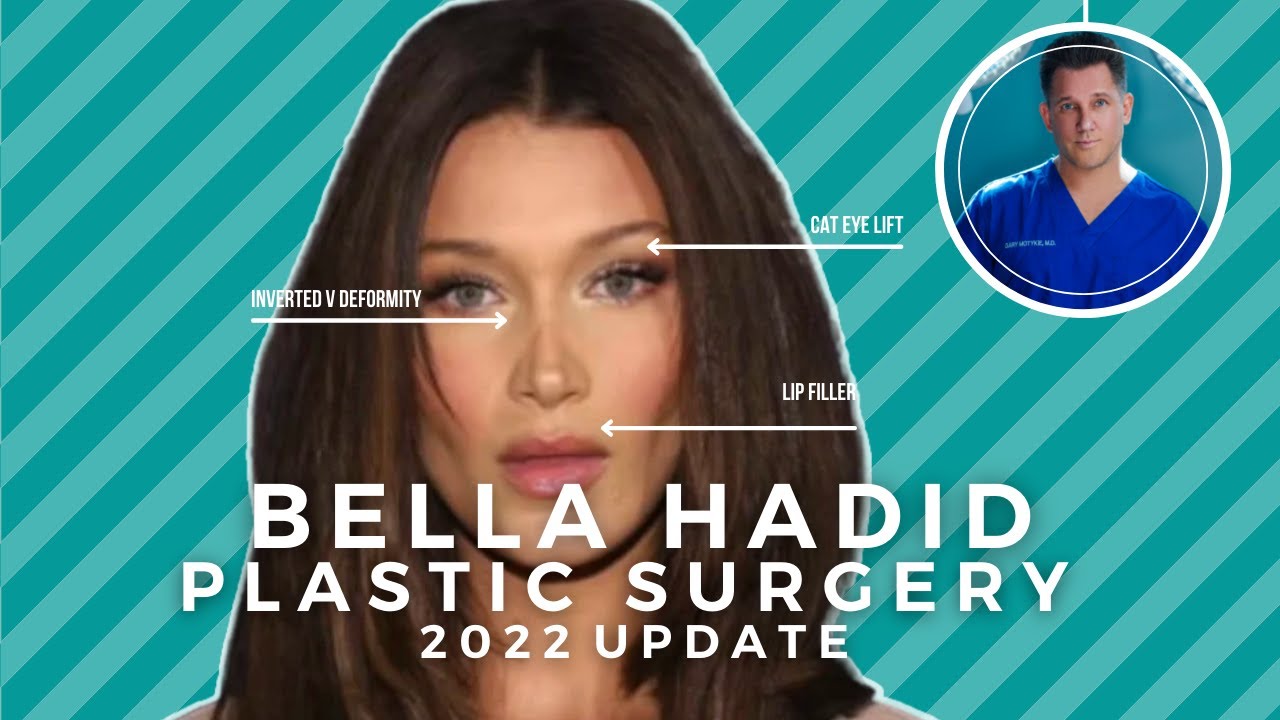 Bella Hadid UPDATE: Plastic Surgeon Reacts to Bella admitting to nose job, LYING about eye lift?!