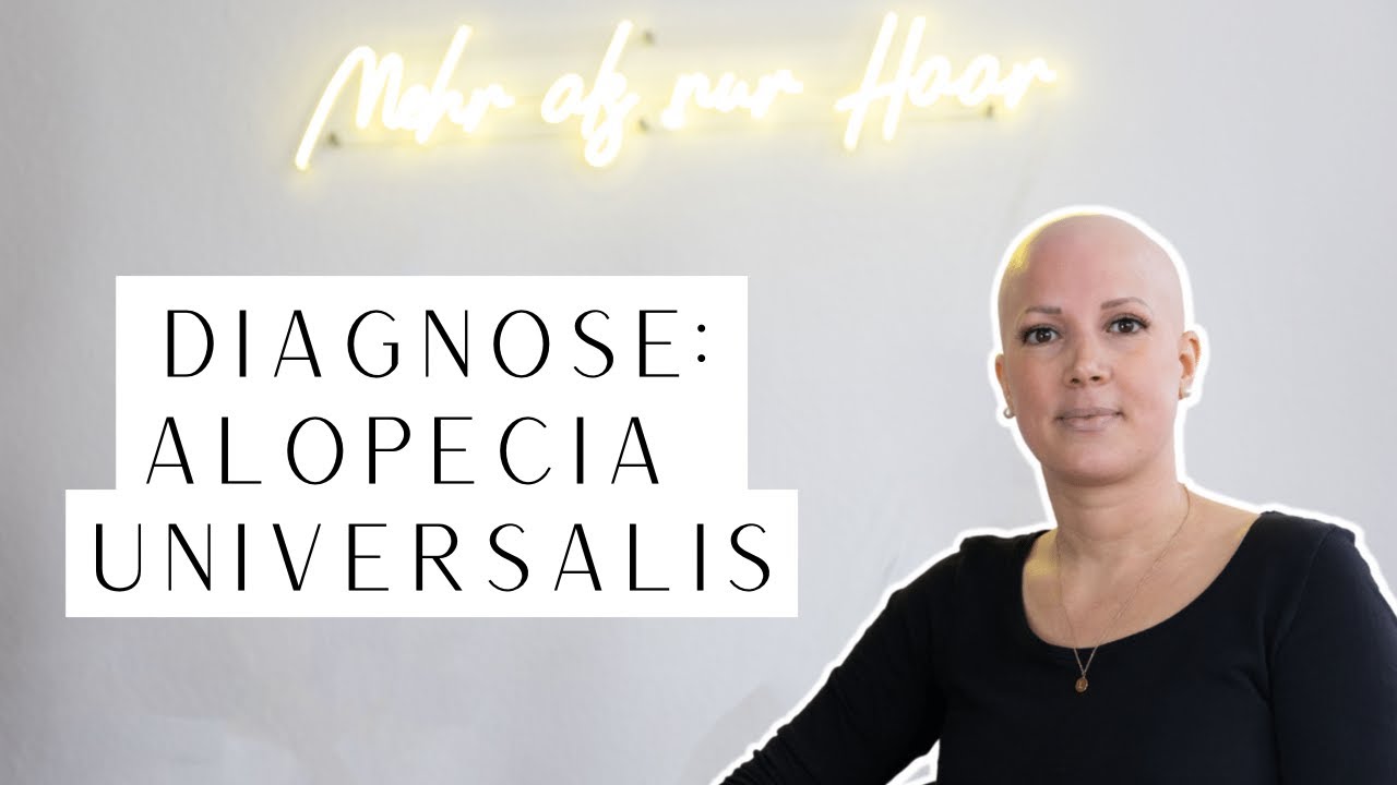 Diagnose Alopecia universalis: Jenny hat alle Haare verloren