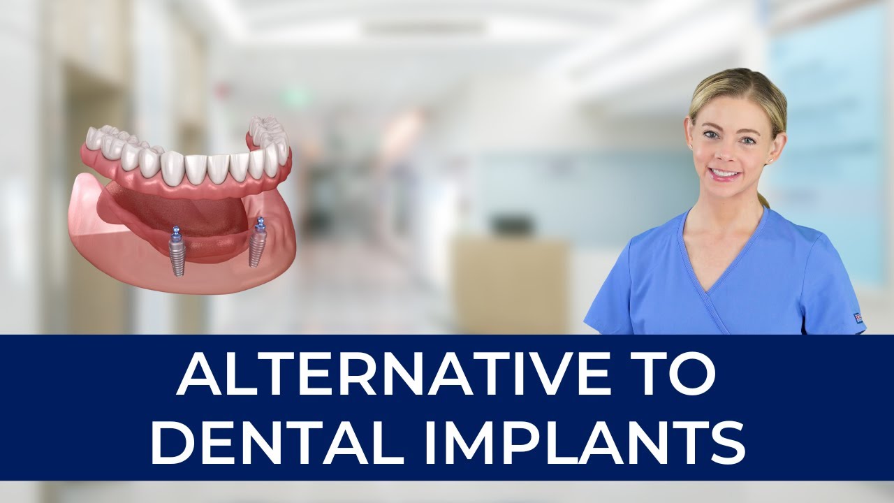 Is There Any Alternative to Dental Implants?