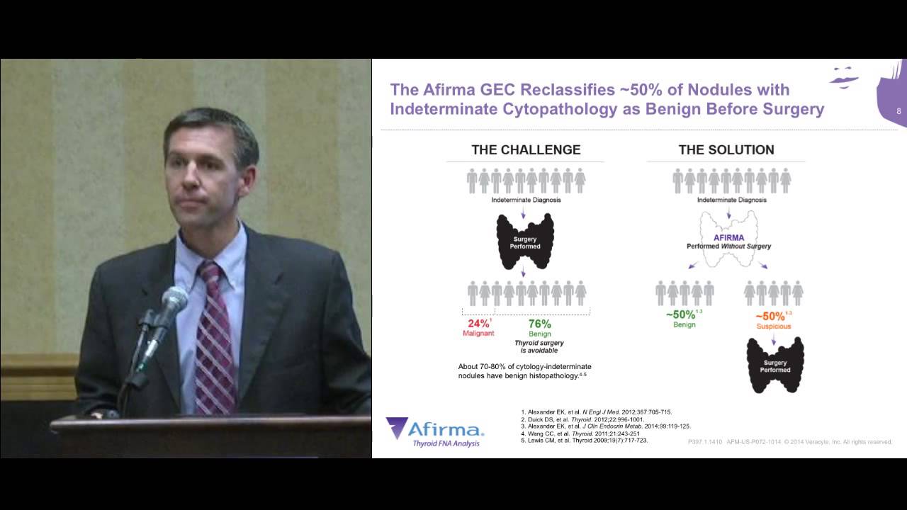 Thyroid Cancer: Afirma Thyroid FNA Analysis & Diagnosing Nodules. Dr. Hungerford. ThyCa Conference