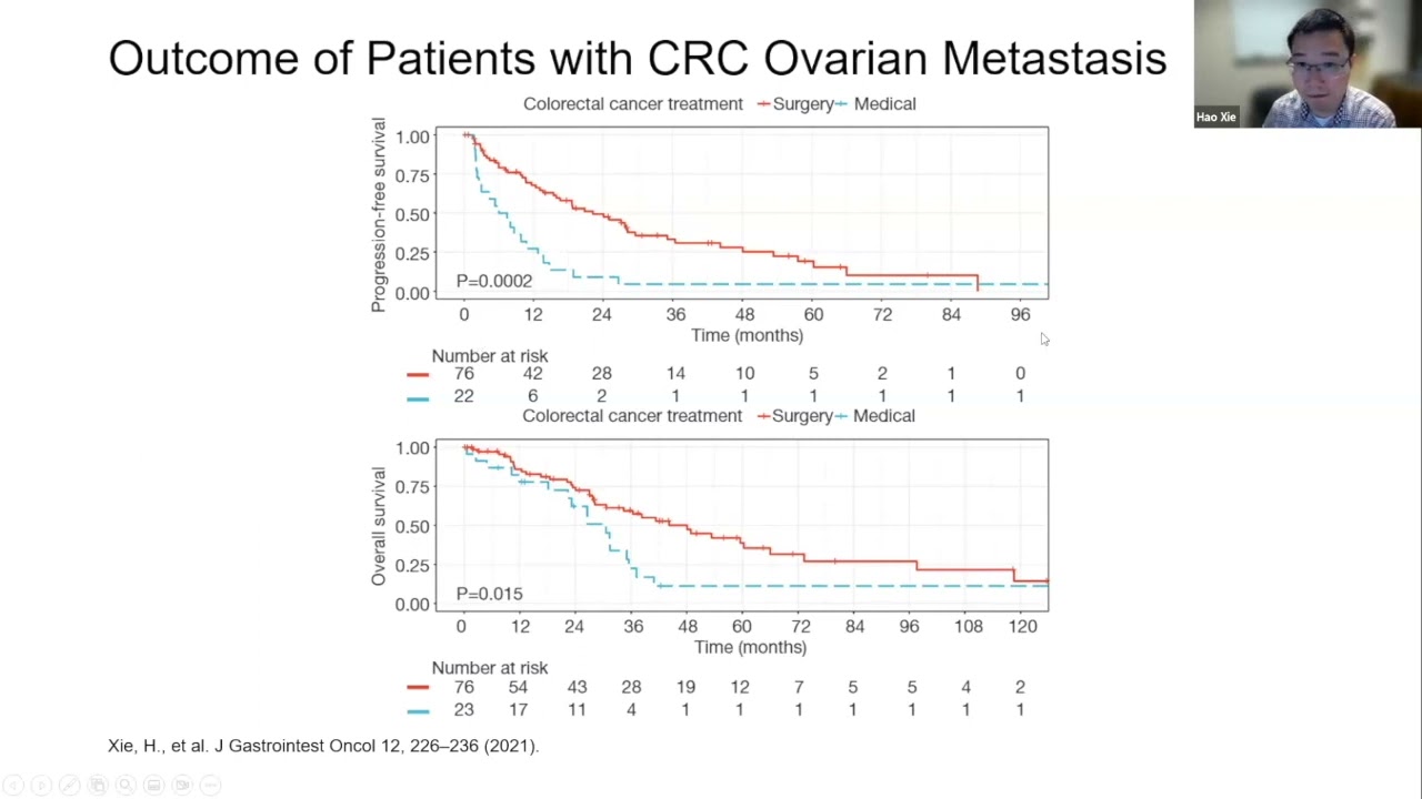 Panel DocTalk on Krukenberg tumors and CRC mets to female reproductive organs: Drs Xie & Sood