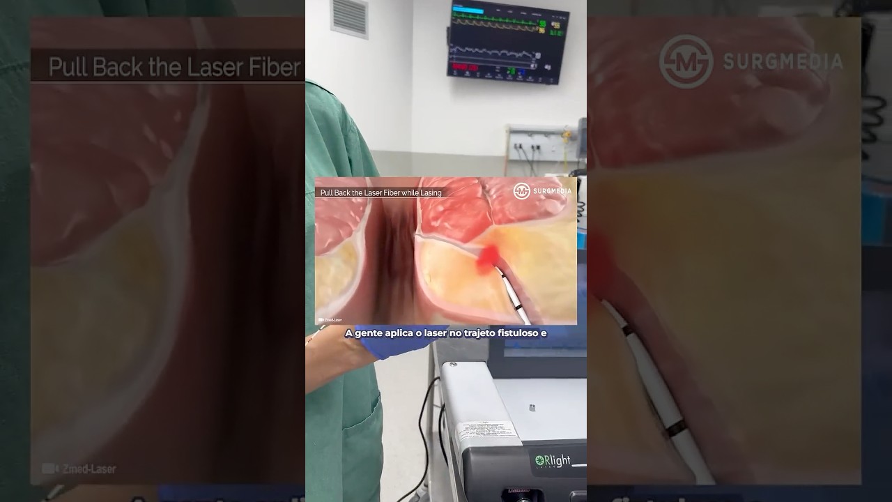 Tratamento de Fístula Anal ⚠️