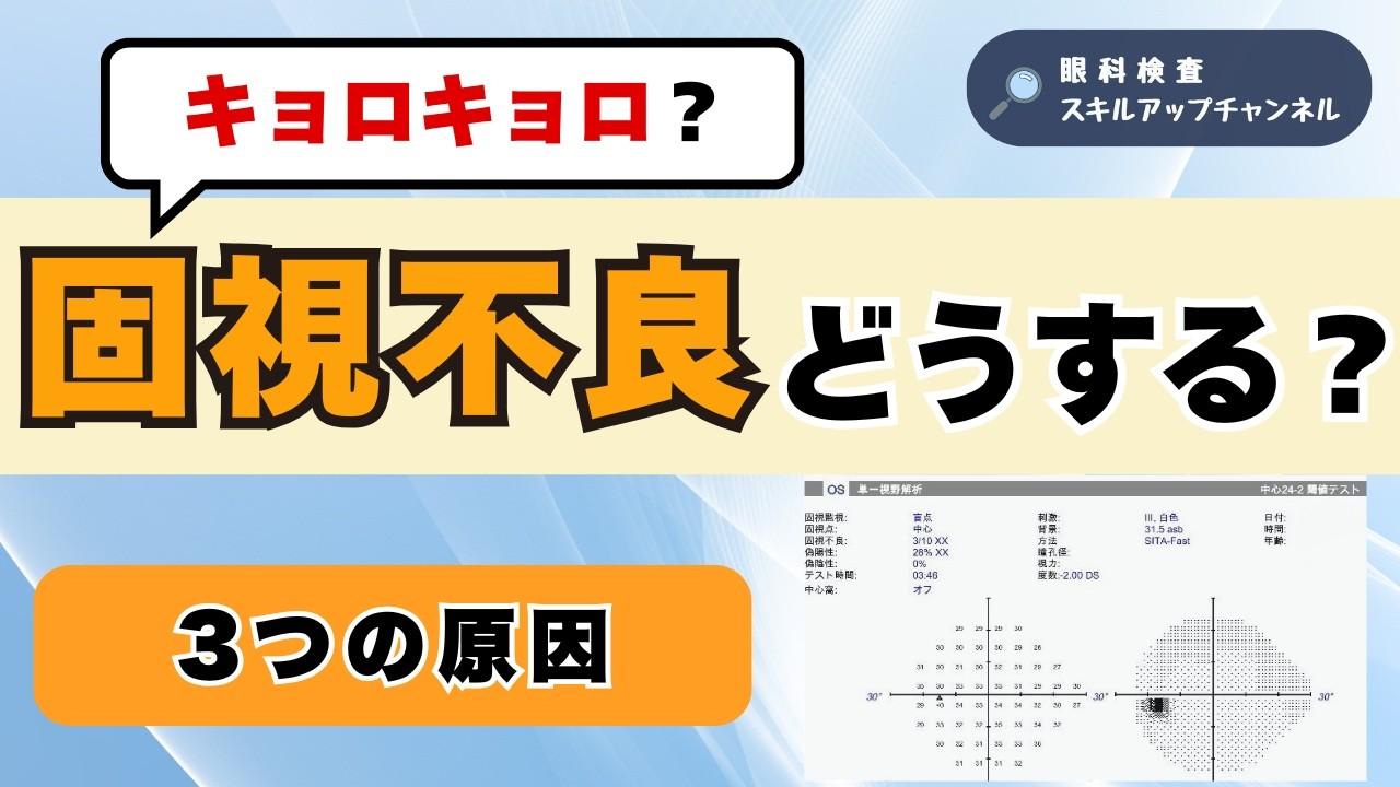 ハンフリー視野検査で固視不良が起こる3つの原因と対処法【眼科検査スタッフ向け】