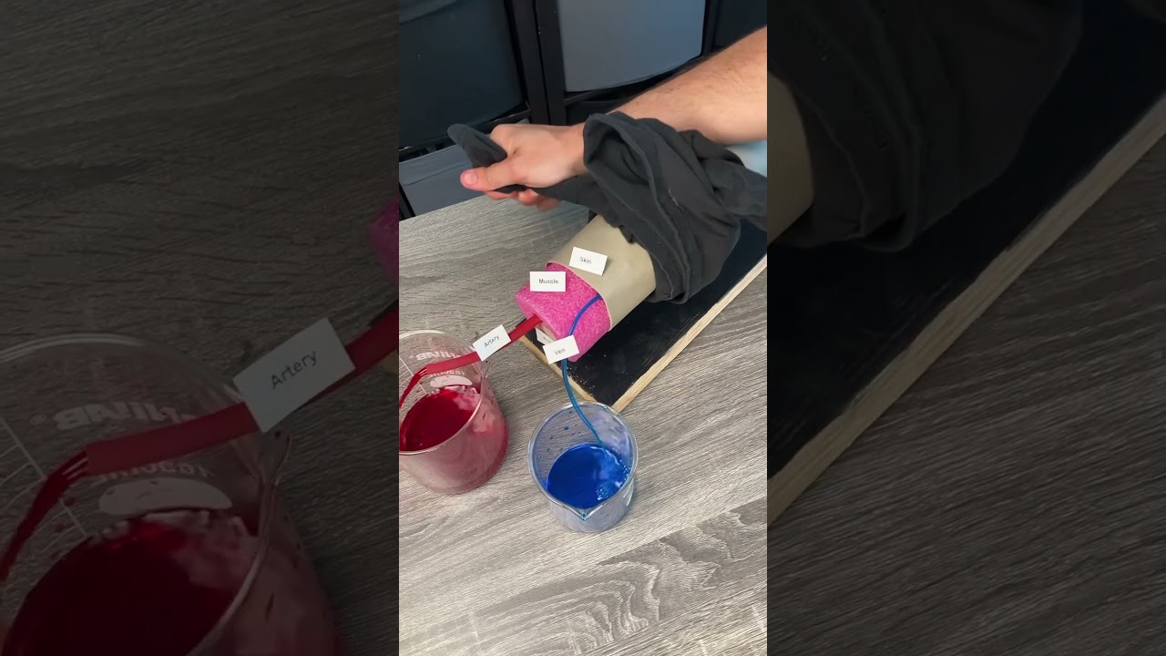 Did your hand get amputated? Try this&hellip;