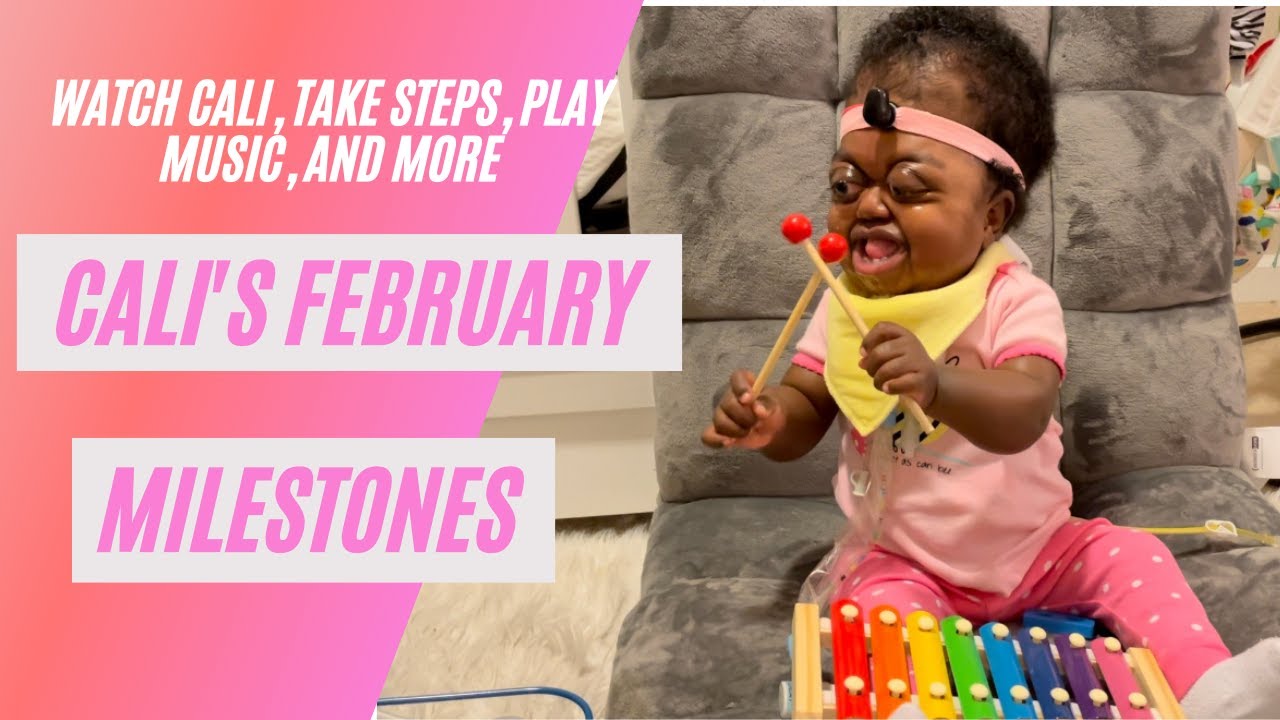 Cali's February Development Milestones | 13 Month Infant| Special Needs| Pfeiffer Syndrome