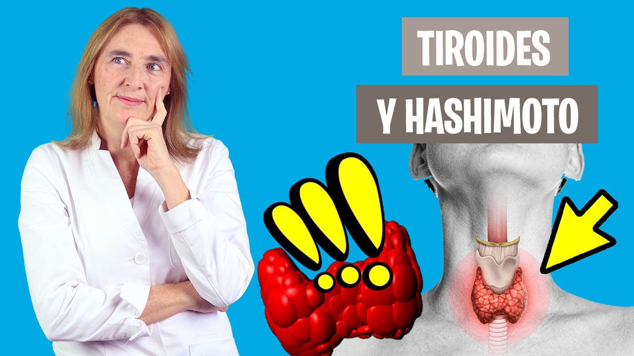 QUÉ ES la TIROIDITIS de HASHIMOTO | Hipotiroidismo de hashimoto | Nutrición clínica