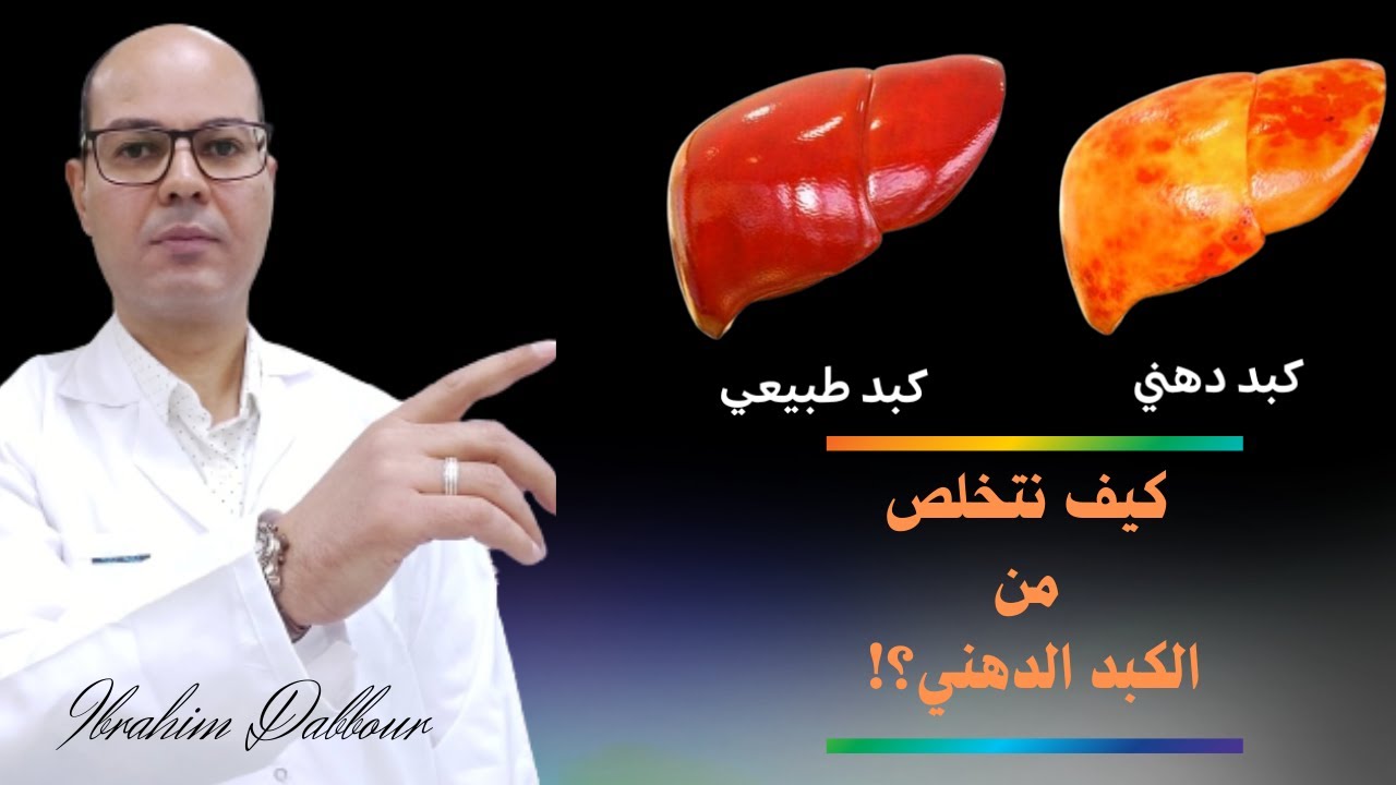 الطريقة الفعالة والاكيدة لعلاج الكبد الدهنى !! للدكتور ابراهيم دبور
