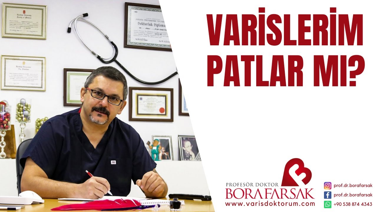 Varislerim patlar mı?