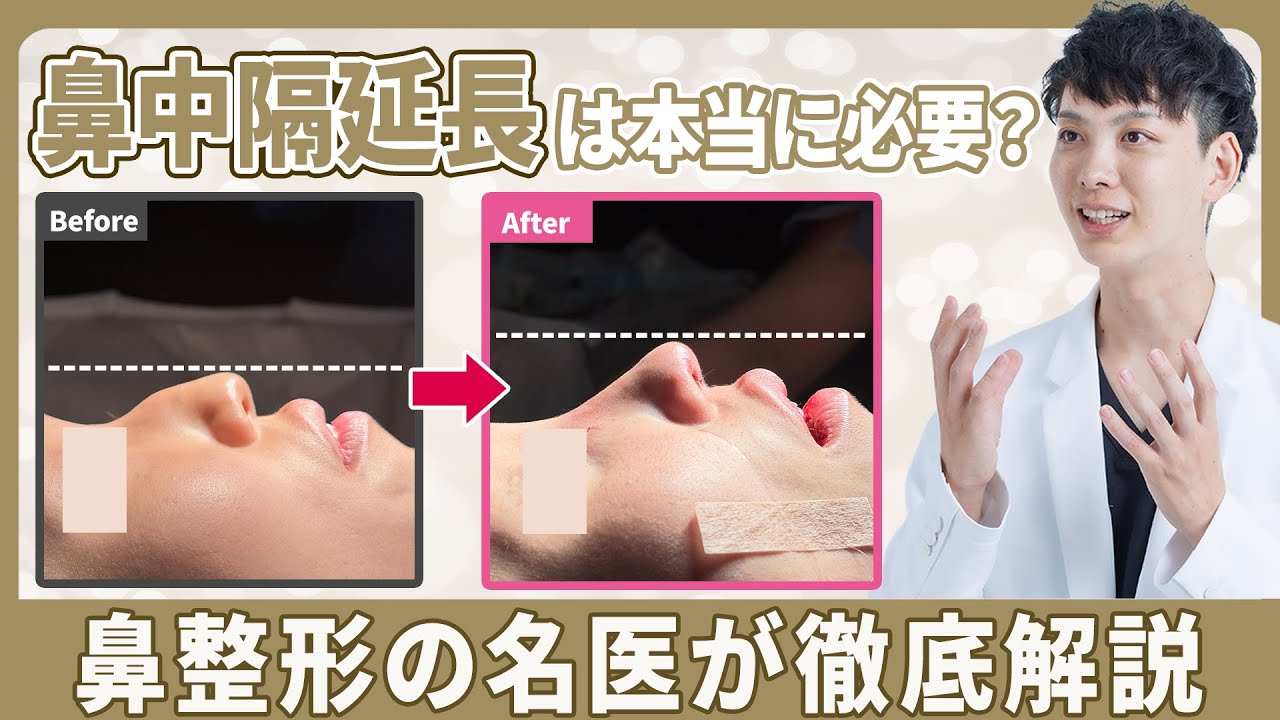 鼻整形する前に必ず見て！鼻中隔延長が必要な人・いらない人の違いを徹底解説 【鼻整形】【美容整形】
