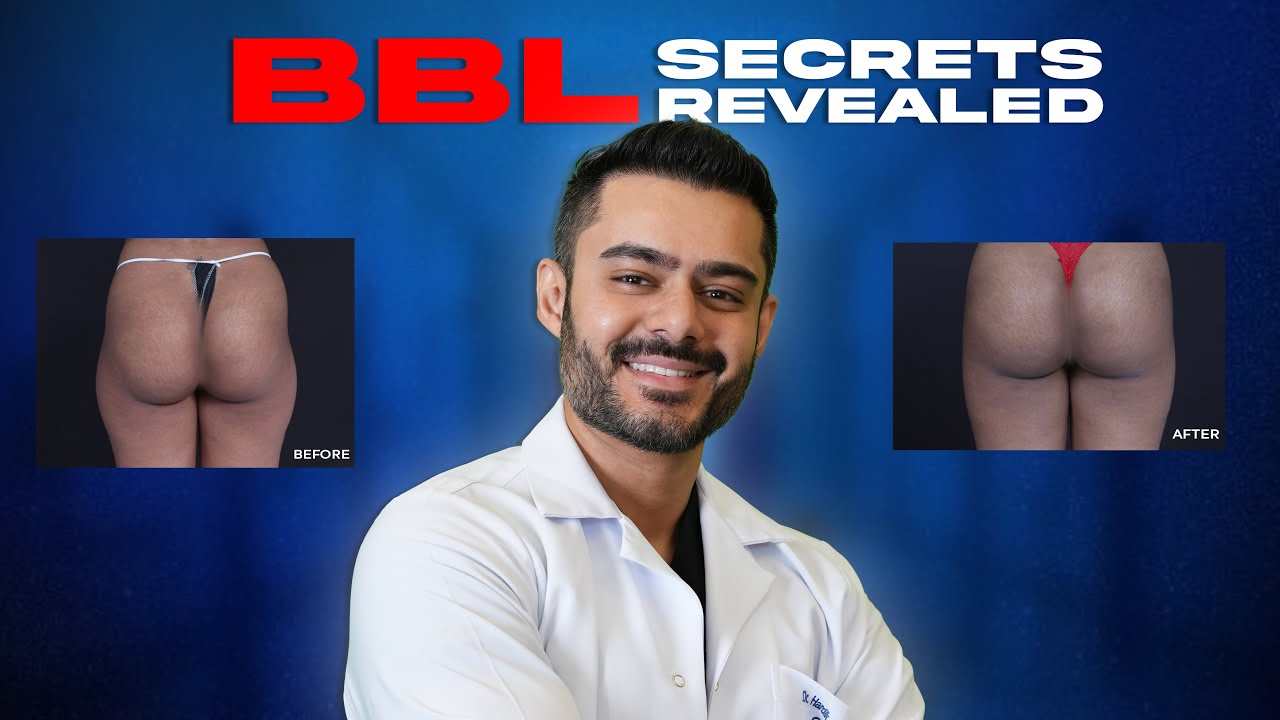 BBL Surgery Explained by a Board-Certified Plastic Surgeon | Everything You Need to Know 2025
