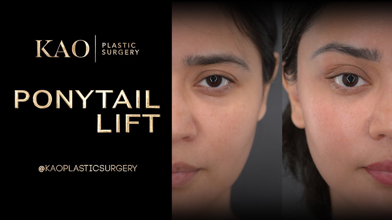 She Wants To Be A Supermodel Her: Beyond the “Cat-Eye” Trend With The Ponytail Lift