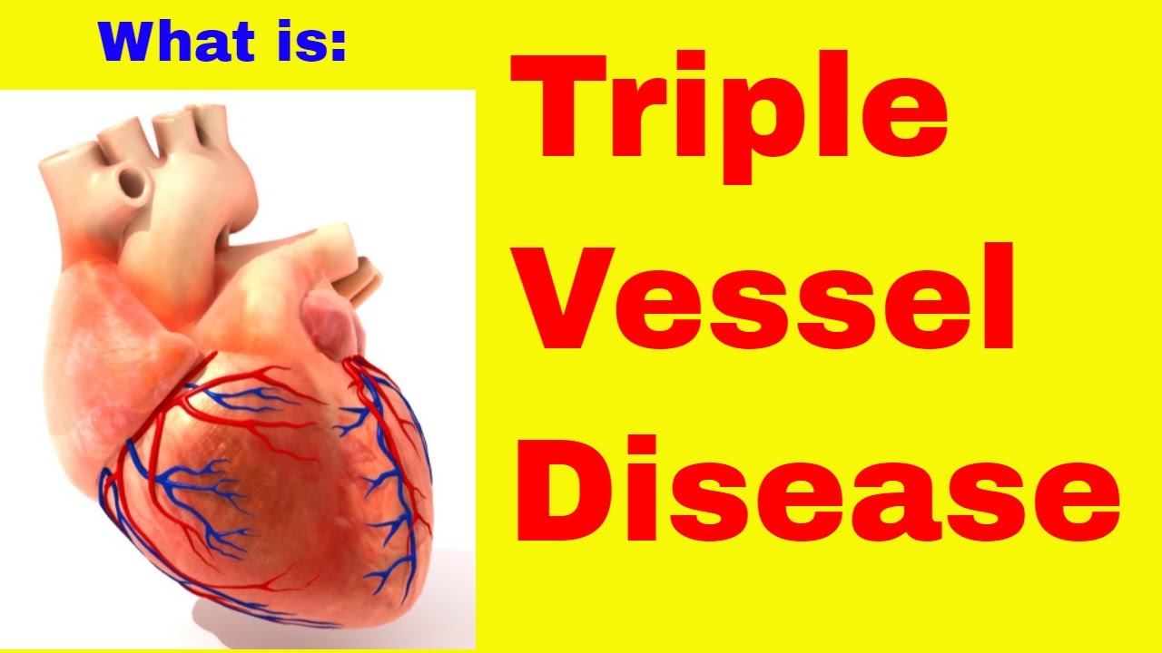 What is Triple Vessel Disease?