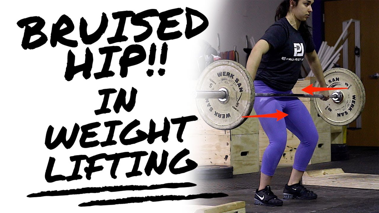 Fixing the Bruised Hip in Weightlifting