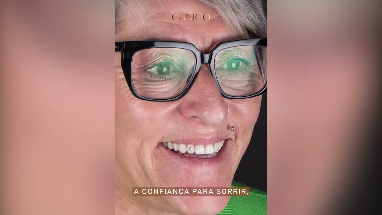 Mude o seu sorriso em Braga - Portugal | Dentes Fixos em 1 Dia