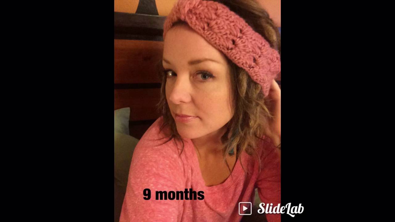 Meg's Dreadlock Timeline 1 week- 1 year 2 months
