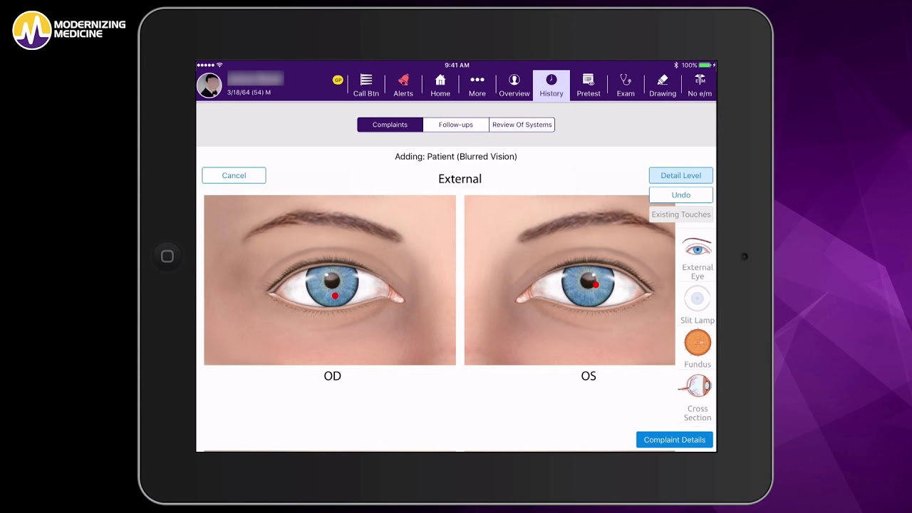 Documenting a Workup in the Ophthalmology EHR, EMA™