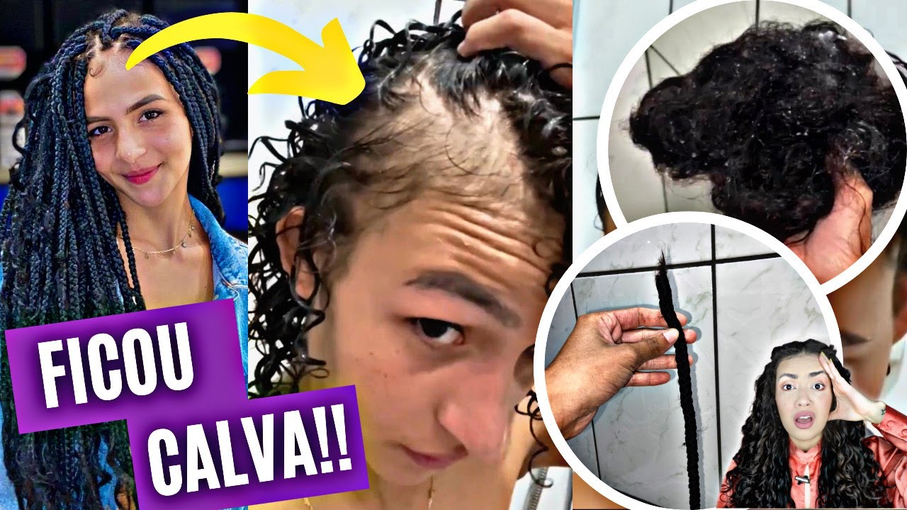 MENINA DIZ TER CABELO ARRANCADO POR TRANÇAS E CHOCA INTERNET! INFORMAÇÕES EXCLUSIVAS DO CASO VIRAL!