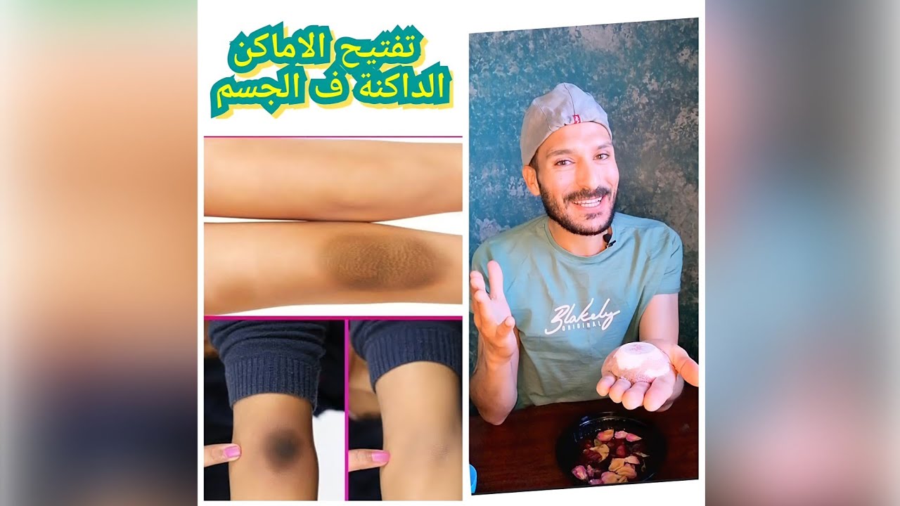 (مشروع مربح) كرة الجمال لتقشير وتفتيح الاماكن الغامقه في الجسم وتطهير وترطيب وتنعيم وتعطير البشرة👌