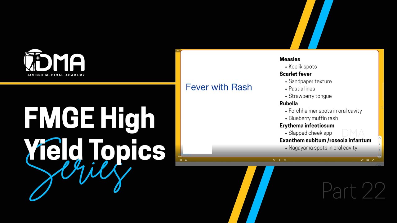 Fever with Rash | DMA's FMGE High Yield Topics - Series | DMA
