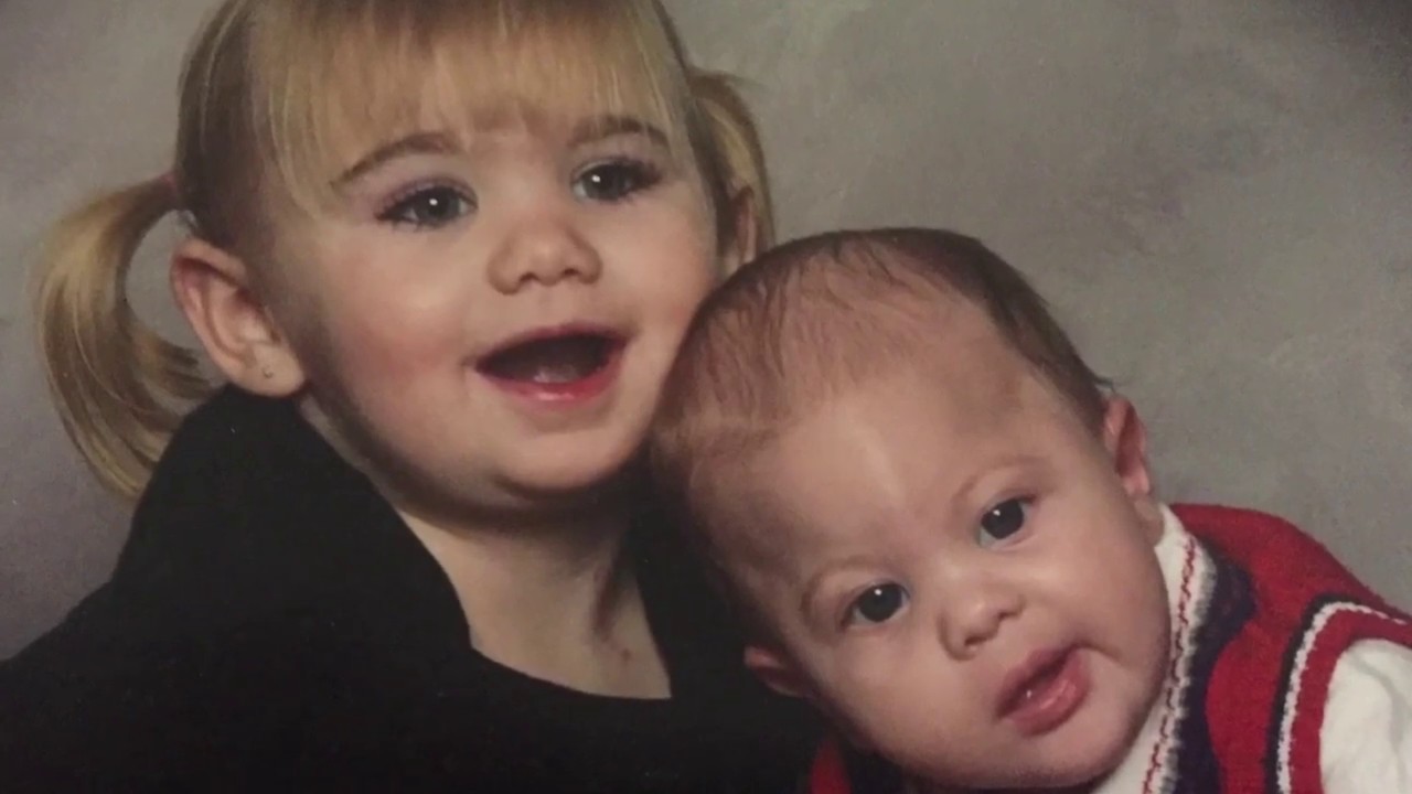 Child Born With Craniosynostosis is helped with Plastic Surgery - The Science of Healing CLIP