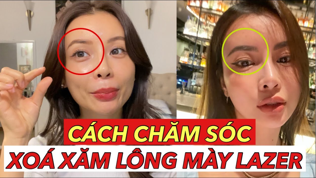XOÁ XĂM LÔNG MÀY BẰNG LAZER VÀ CÁCH CHĂM SÓC