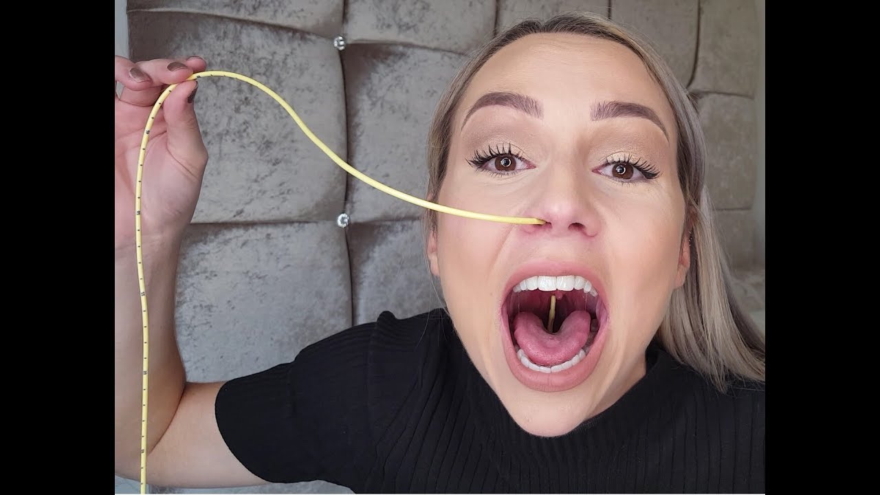 How to remove, clean and re-insert an NG Tube EASILY!! #Making life easier