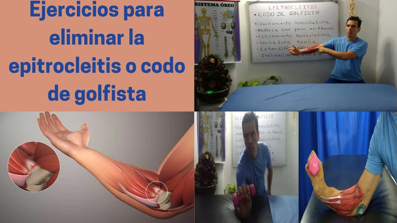 Epitrocleitis O Codo De Golfista