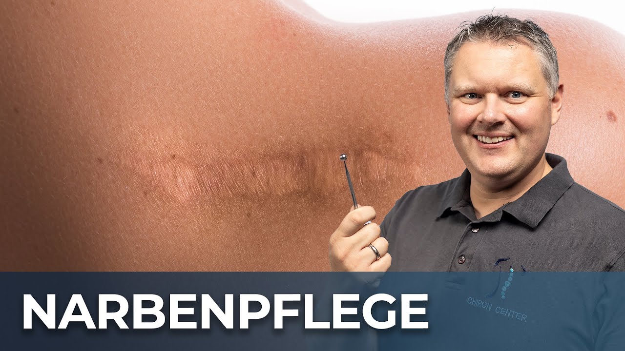 Narbenpflege mit Faszientherapie: Wie Du Deine Narben effektiv behandeln kannst