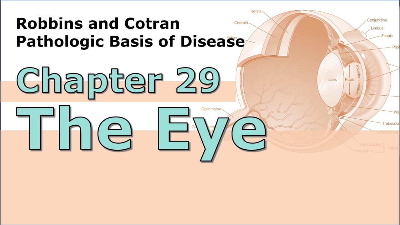 【Robbins病理學】Chapter 29 The Eye