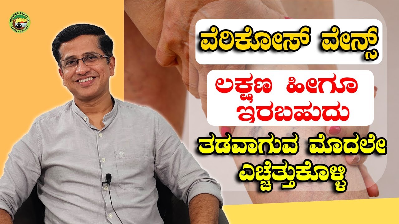 ವೆರಿಕೋಸ್ ವೇನ್ಸ್  ಲಕ್ಷಣ ಹೀಗೂ ಇರಬಹುದು  ತಡವಾಗುವ ಮೊದಲೇ ಎಚ್ಚೆತ್ತುಕೊಳ್ಳಿ