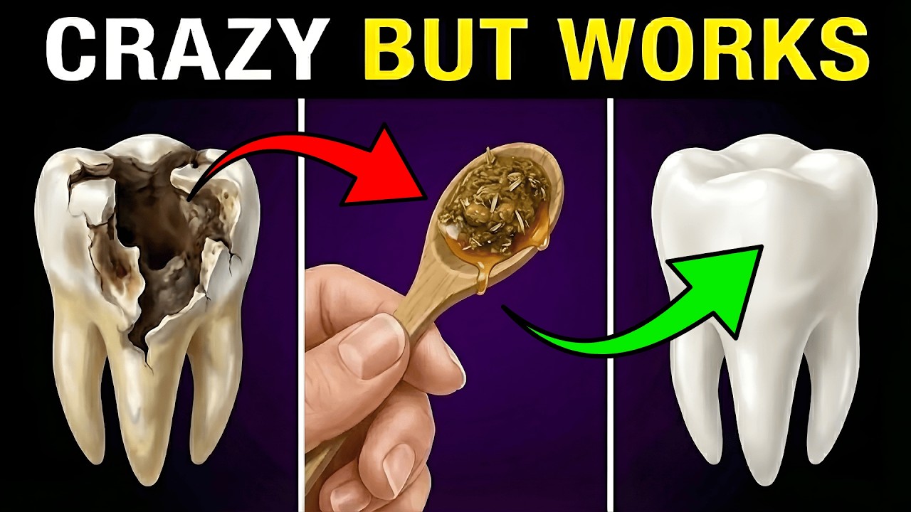 Receding Gums? #1 Secret Reverses Cavities Naturally