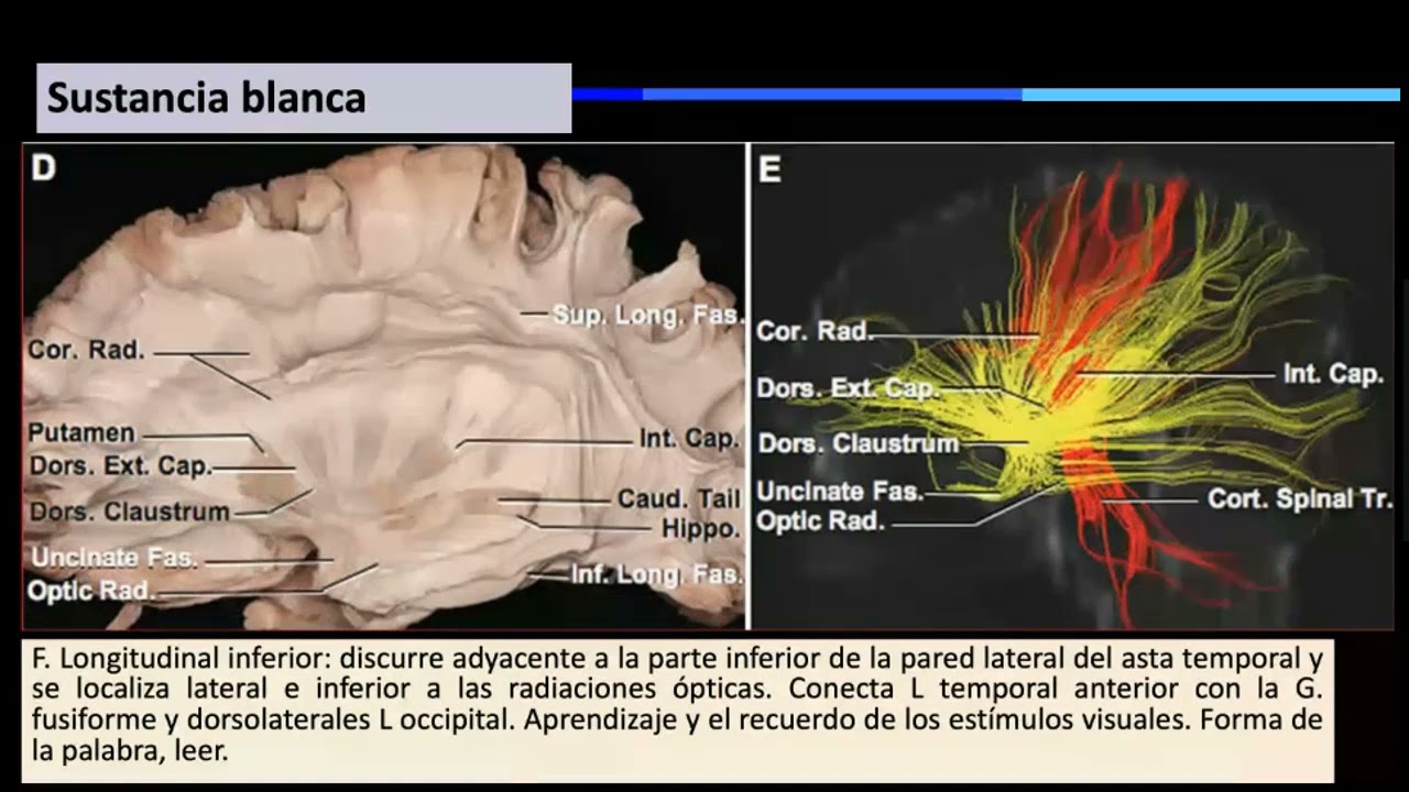 Anatomía quirúrgica del lóbulo temporal