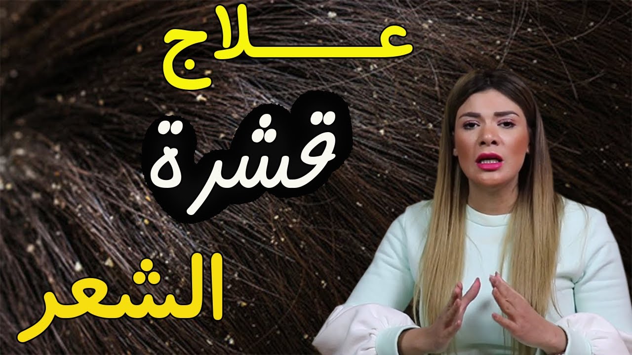علاج قشرة الشعر