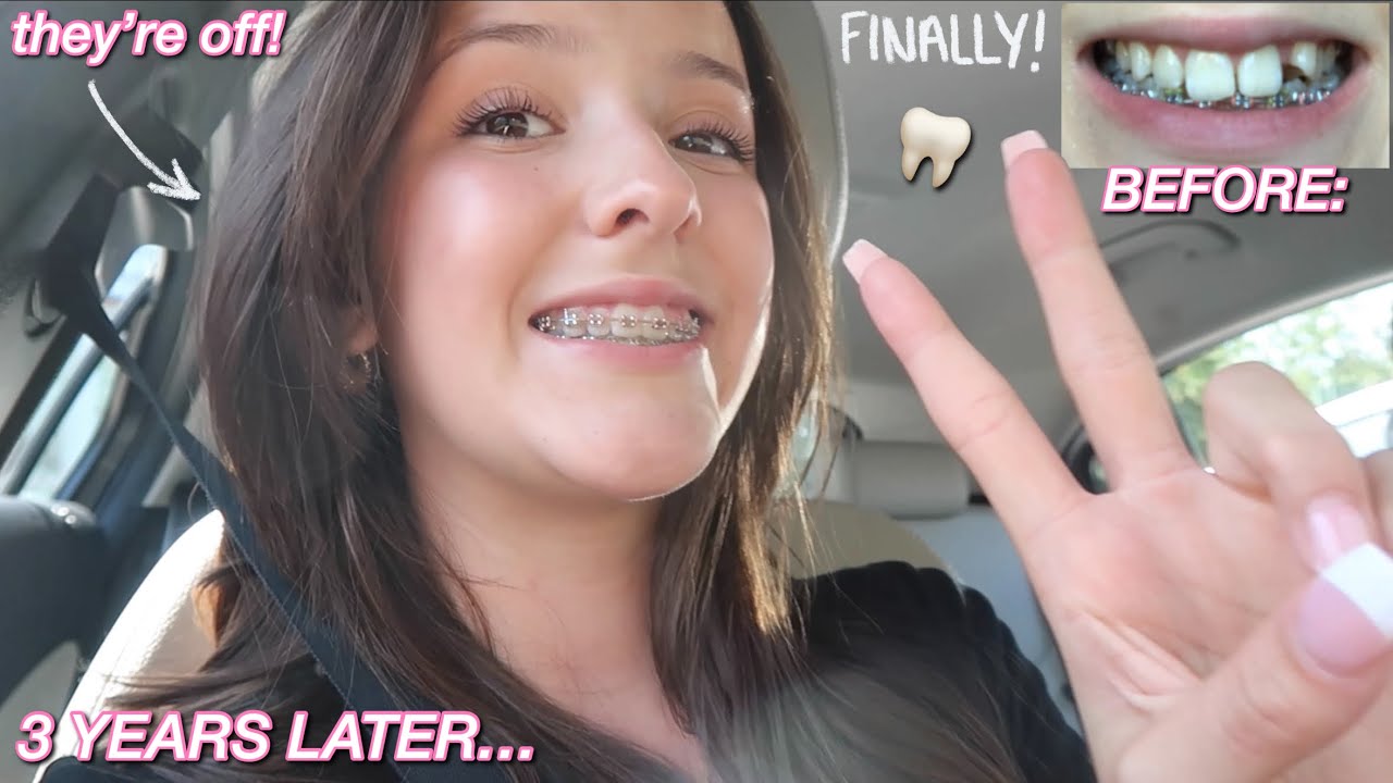 GETTING MY BRACES OFF! finally lol
