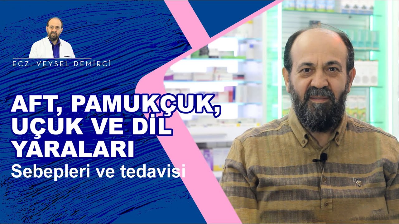 AFT, PAMUKÇUK, UÇUK VE DİL YARALARININ SEBEPLERİ NELERDİR? NASIL GİDERİLİR?