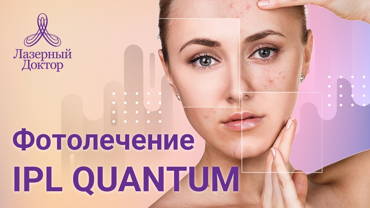 IPL Фотолечение Quantum (удаление пигментации и сосудов)