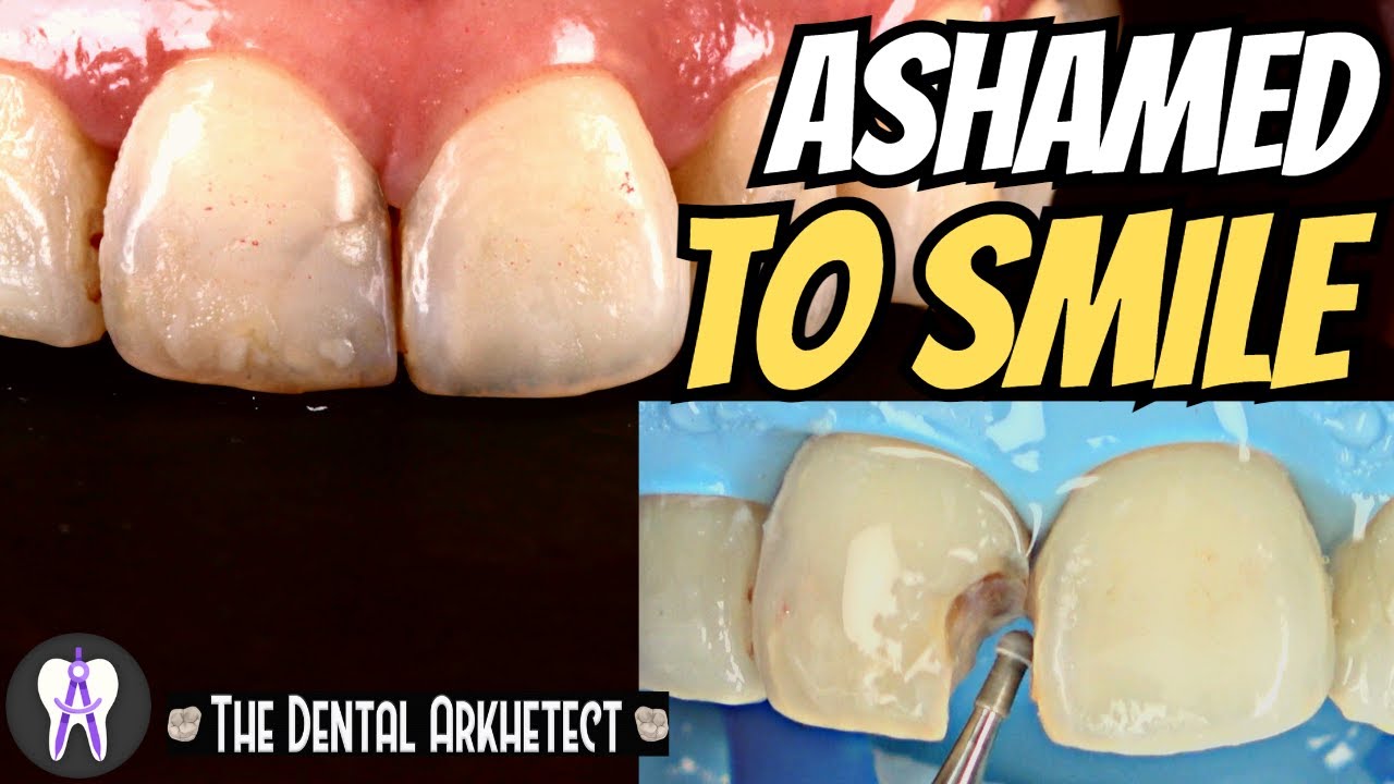 Restoring Patient's Confidence #KIS #C49 #4k