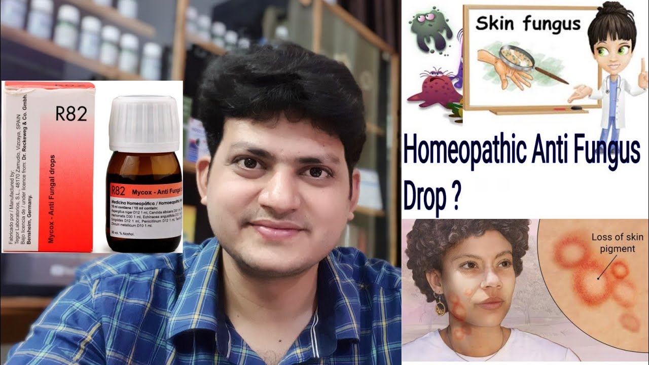 German Antifungal drop | Homeopathic Medicine for fungal infection ?