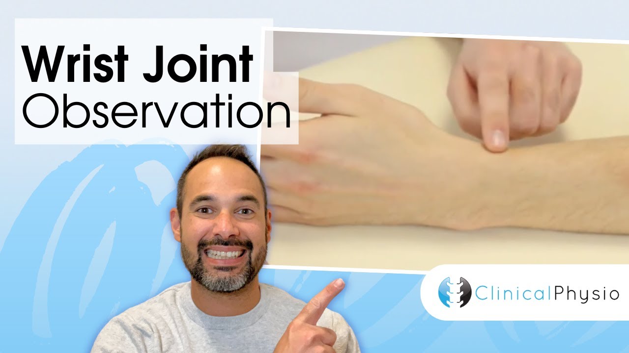 Wrist Joint Observation | Clinical Physio