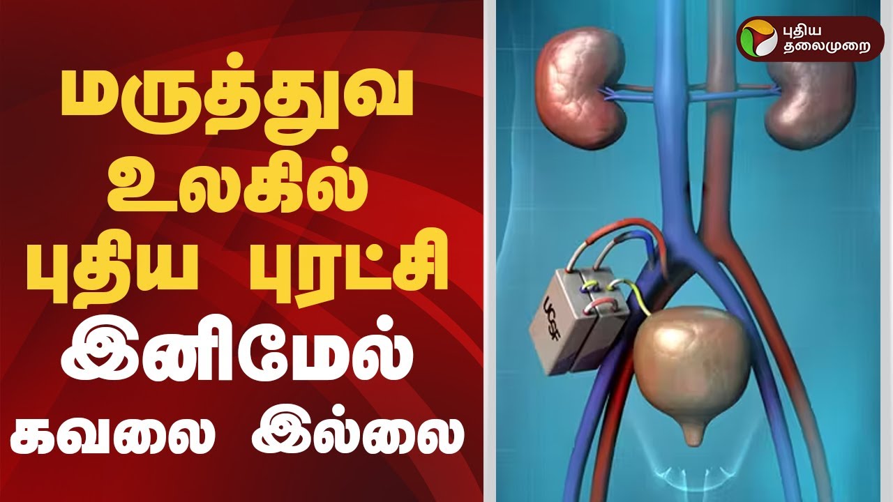 மருத்துவ உலகில் புதிய புரட்சி-உயிர்காக்கும் செயற்கை சிறுநீரகம்..! | (kidneys)