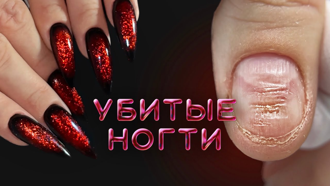 что делать, когда от ногтей ничего не осталось, но очень надо 🫣 убитые ногти | гелевые типсы