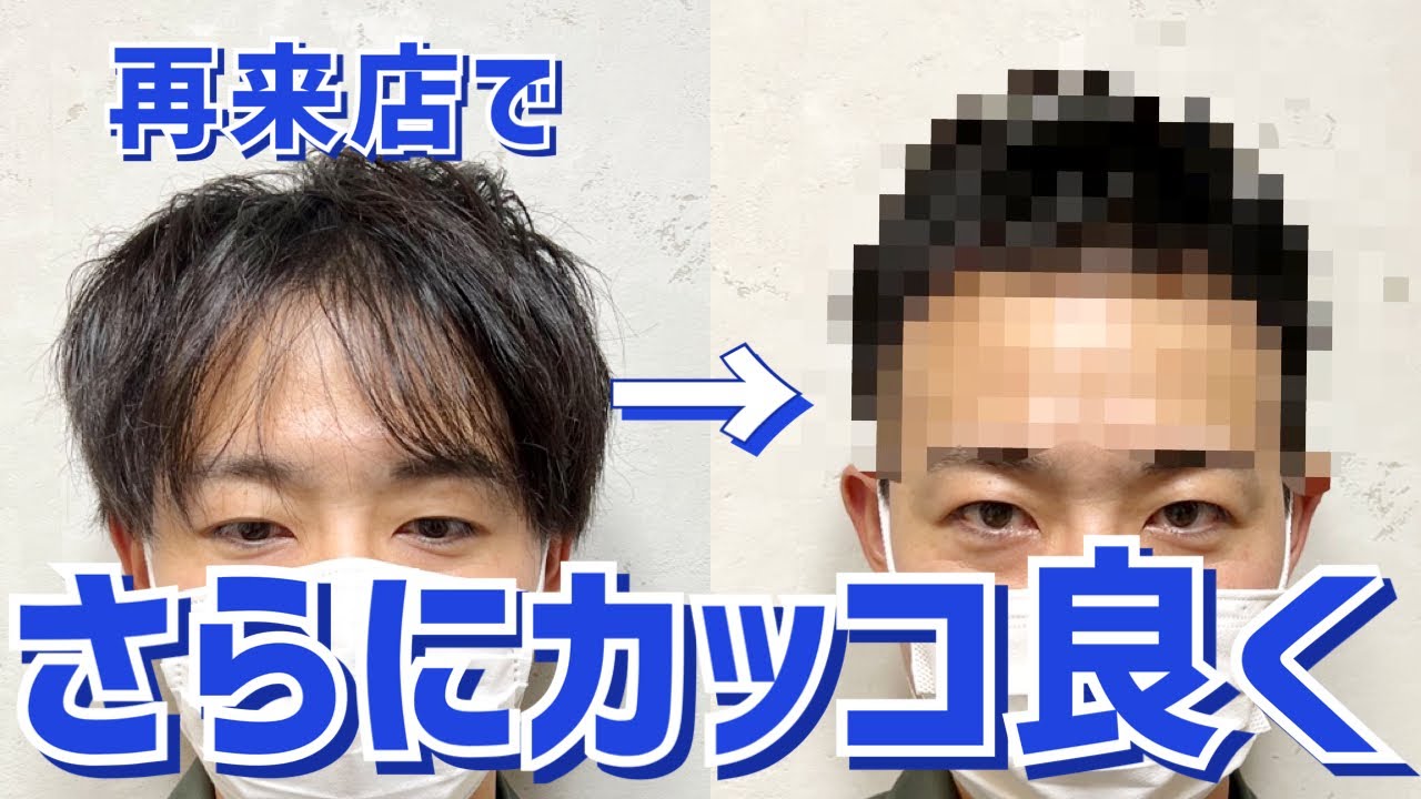 【M字ハゲ】センターパートから１ヶ月。今回は短髪スタイルに！